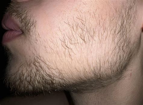 0 month vs 3 months vs 6 months vs 9 months. Started being more