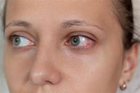 life  eye trauma retina specialists retinal ophthalmologists