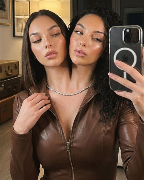 Who Are Valeria and Camila? The Real Story Behind Viral Conjoined Twins