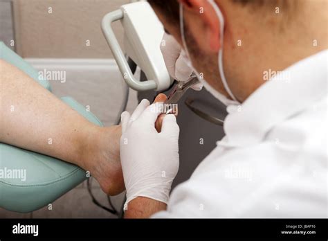 Fußpfleger schneidet mit Zange Zehennägel Stock Photo - Alamy