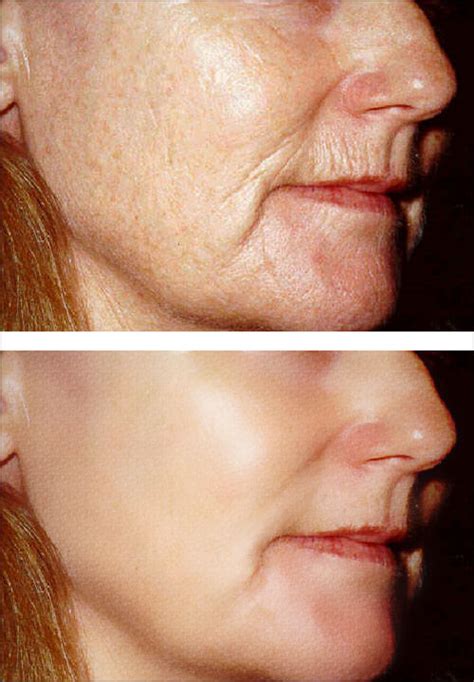 dont  picture design swan