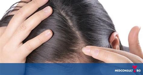 Проблеми на скалпа и косата — Medconsult.bg