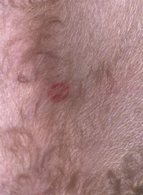 Ringworm or fly bite? : r/DogAdvice