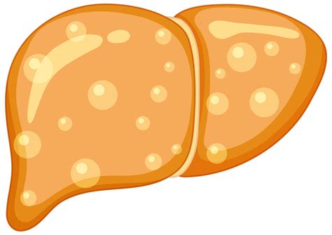 SGLT2 Inhibitors Superior to Other Oral Diabetes Drugs for People with