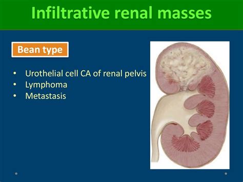 Renal mass