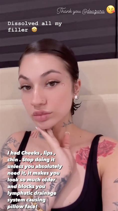 Bhad Bhabie dissolved her fillers, warns people to stop getting them