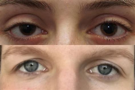 eye opening differences unveiling  secrets  prey  predator