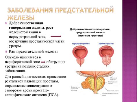 Мужская половая система - презентация онлайн