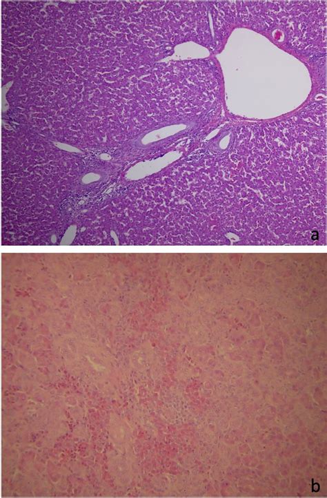 Image:Normal and affected chicken livers-Merck Veterinary Manual