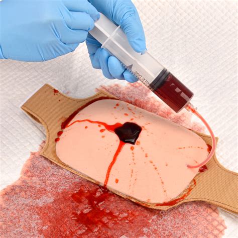 Evisceration Of Wound 4