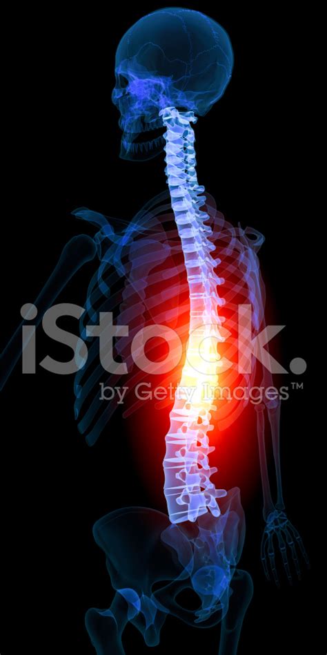 Backache Stock Photo – Royalty-Free Images | FreeImages
