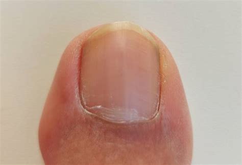 big toe anatomy stock  pictures royalty  images istock