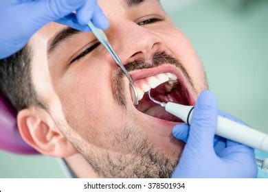 plaque removal images stock  vectors shutterstock