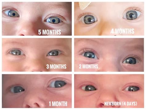 newborn eye color change chart baby eye color chart