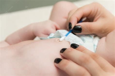 Cotonete Para Limpar Umbigo De Bebe - A mãe usa um cotonete para limpar o umbigo [download] - Designi
