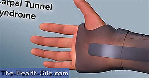 Tunnel Syndrome 💊 Scientific-Practical Medical Journal - 2025