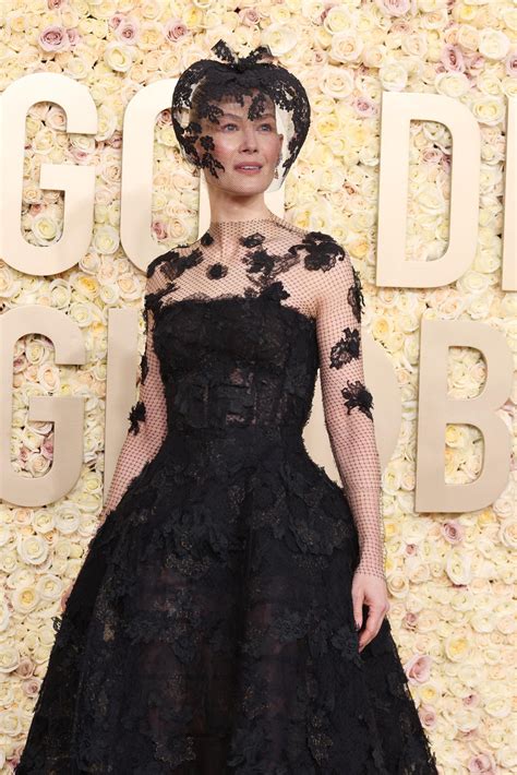 Saltburn's Rosamund Pike overcomes "smashed" face from skiing at Golden