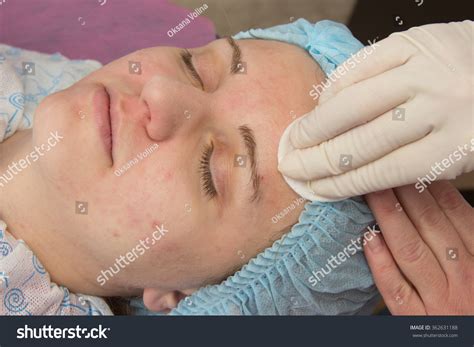 Professional Cleansing Acne Beauty Salon Stock Photo 362631188 ...