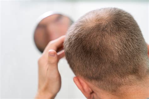 How Long Does It Take for Hair to Grow Back After Hair Loss