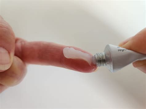 topical corticosteroids  eczema flare control eczema support australia