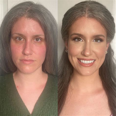 Before and After