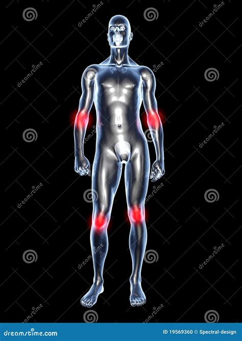 Joint ache - Anatomy stock illustration. Illustration of infection