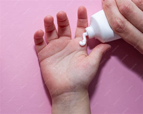 premium photo childrens atopic skin moisturizing  skin