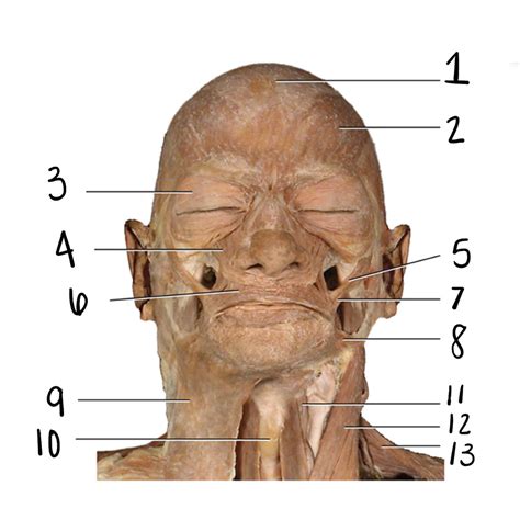 anterior facial cadaver terms diagram quizlet