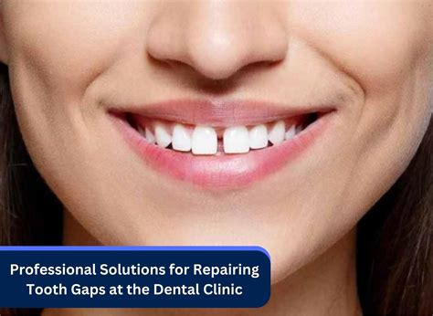 Professional Solutions for Repairing Tooth Gaps at the Dental Clinic