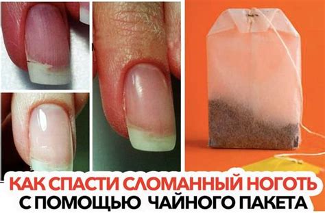 Что делать, если ноготь сломался, в том числе сбоку под гель-лаком: как ...