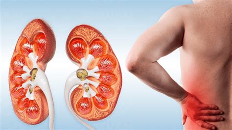 when to stop metformin in chronic kidney disease