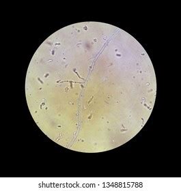 Microscope View Fungi Mycelium Filaments Increase Stock Photo ...