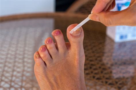 Proper Use Of Nail Antifungal Solution - Foot Care Products - FootDocStore