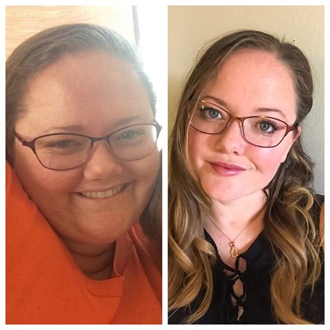 Weight Loss Hair Before And After at Gertrude Murphy blog