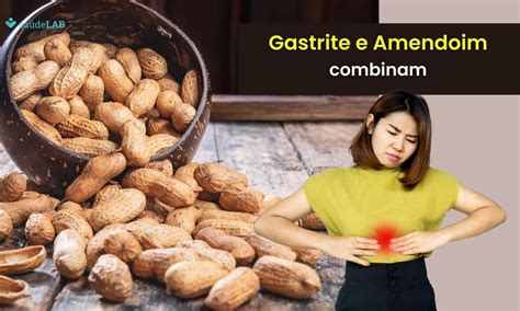 Amendoim Faz Mal Para Gastrite - Quem tem gastrite pode comer amendoim? Entenda melhor a questão