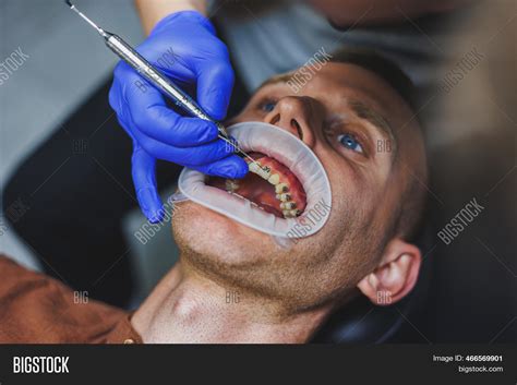 dental treatment teeth image photo  trial bigstock
