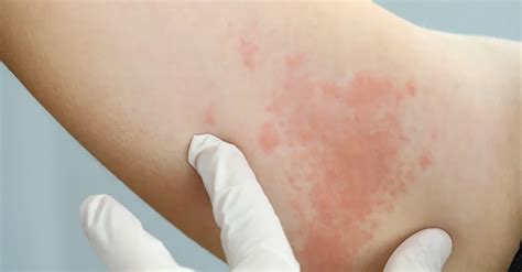 Different Types of Skin Conditions and Their Treatments – Skin bio
