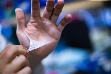 temple university bioengineers invent skin substitute