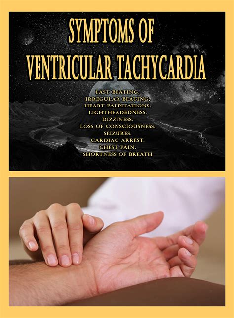 Buy Symptoms of Ventricular Tachycardia: Fast beating, Irregular