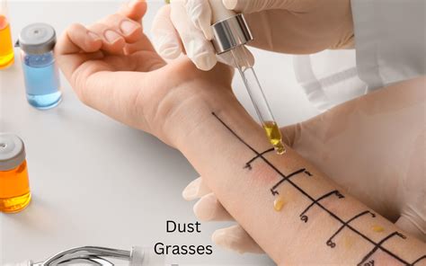 allergy testing   meets  eye auckland skin clinic