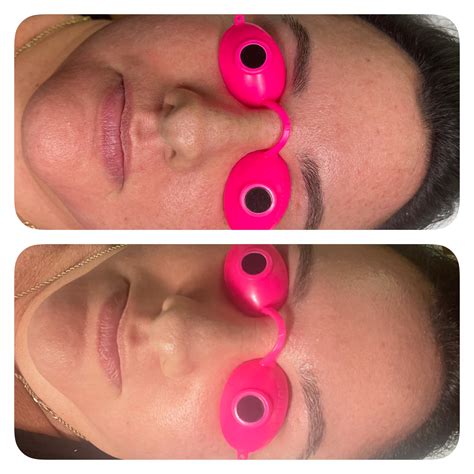 Facial Services | Naples Laser & Skin Aesthetics | Naples, FL