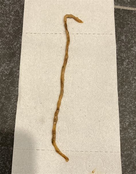 Worm?! After 11 day waterfast this came too with my bowel movement… wtf