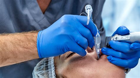 intubation ventilation naemsp endotracheal intubation   ems