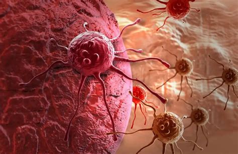 ¿Qué es el cáncer y cómo se expande por el organismo? - Como Funciona Que