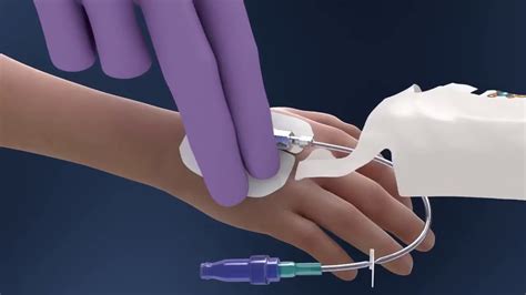 Tegaderm IV Advanced Dressing Pediatric Video application - YouTube