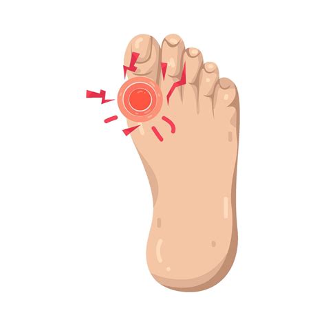 Pain Relief for Foot Issues and Injuries 69759096 Vector Art at Vecteezy