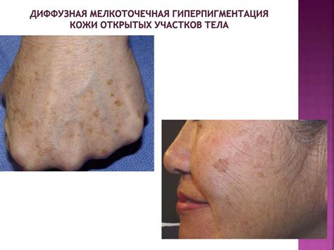 Внешние проявления различных патологических состояний - презентация онлайн