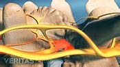 Facet Joint Injection Procedure | Spine-health