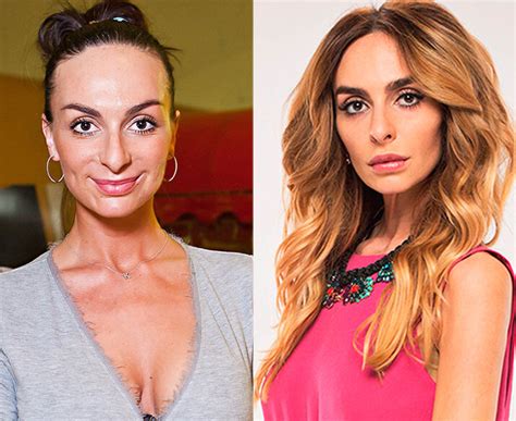 Как выглядела до пластики и какие операции делала Екатерина Варнава ...