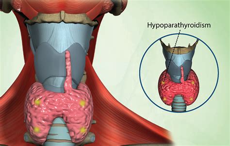 Health Symptoms : Causes, Treatment, Conditions and More